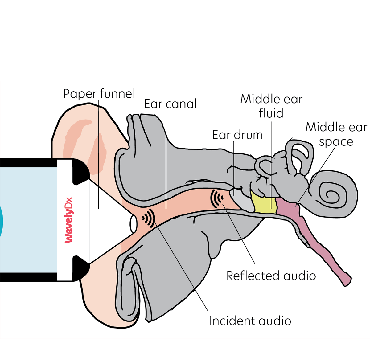  The app directs soft, painless chirps towards the ear drum and records the reflection. 