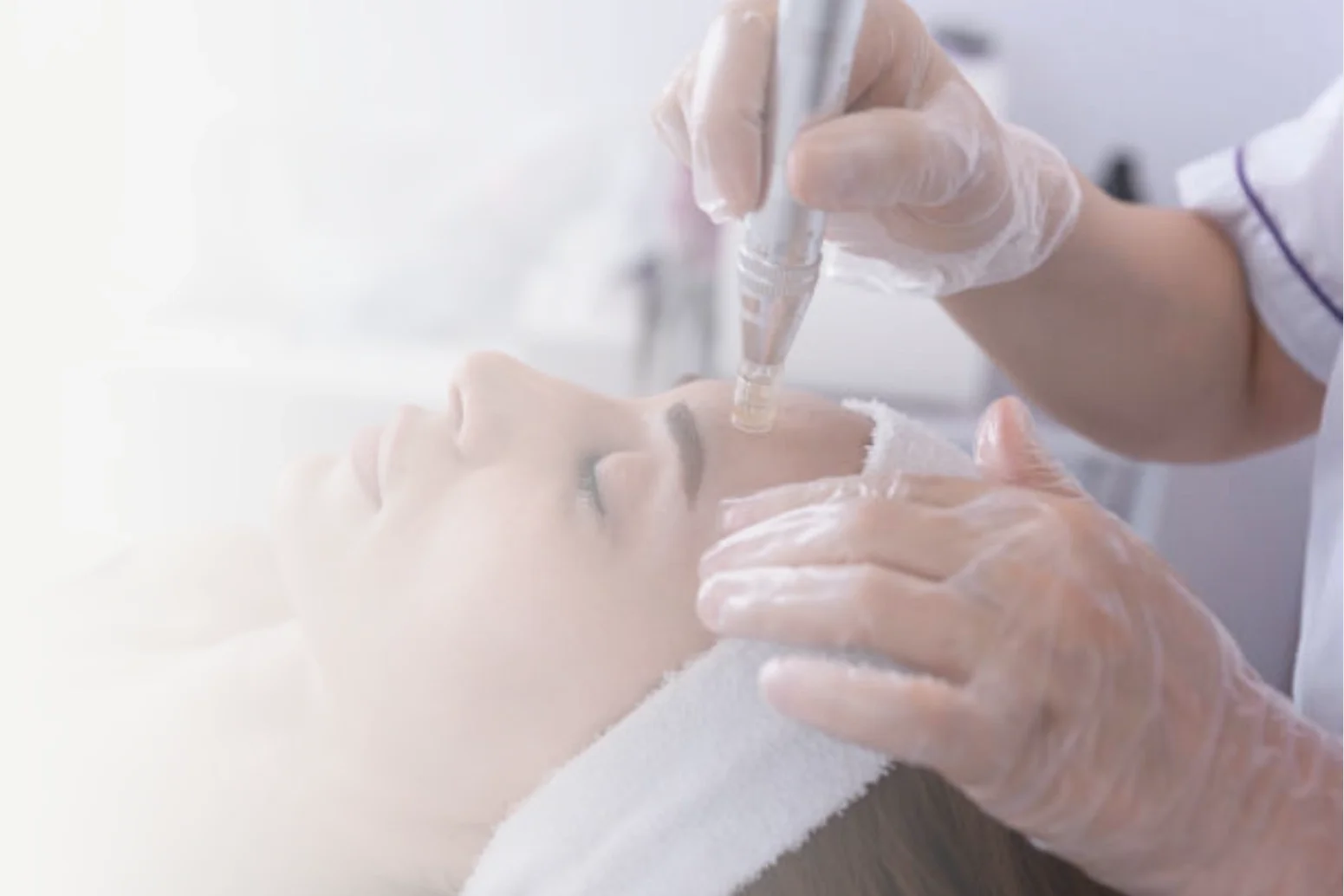 microneedling at Empirical Medicine in Glendale, AZ