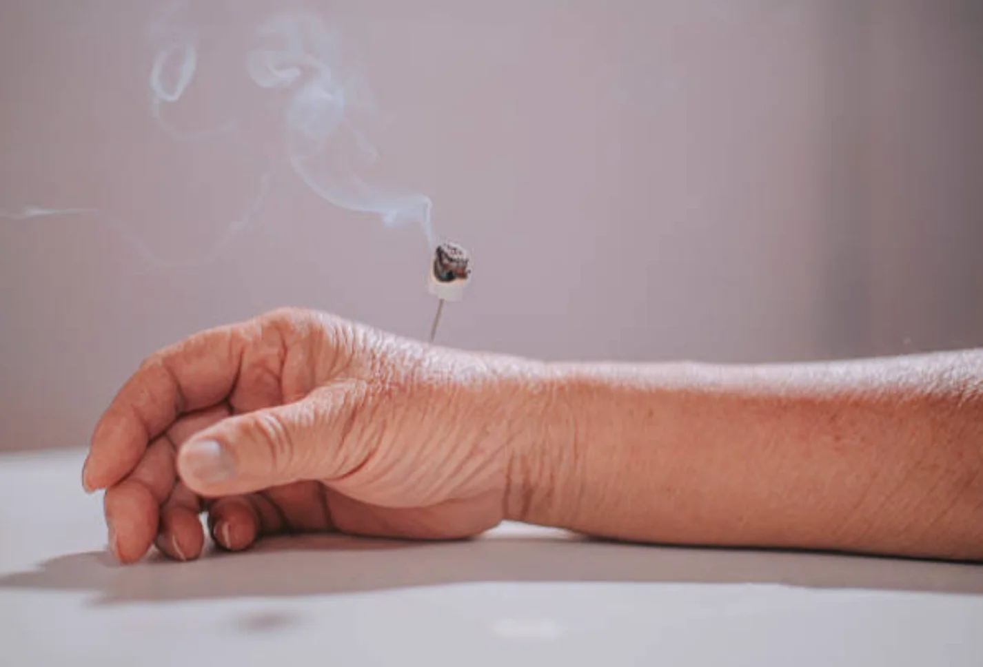 Patient receiving a moxibustion or moxa treatment in Empirical Medicine in Glendale, AZ