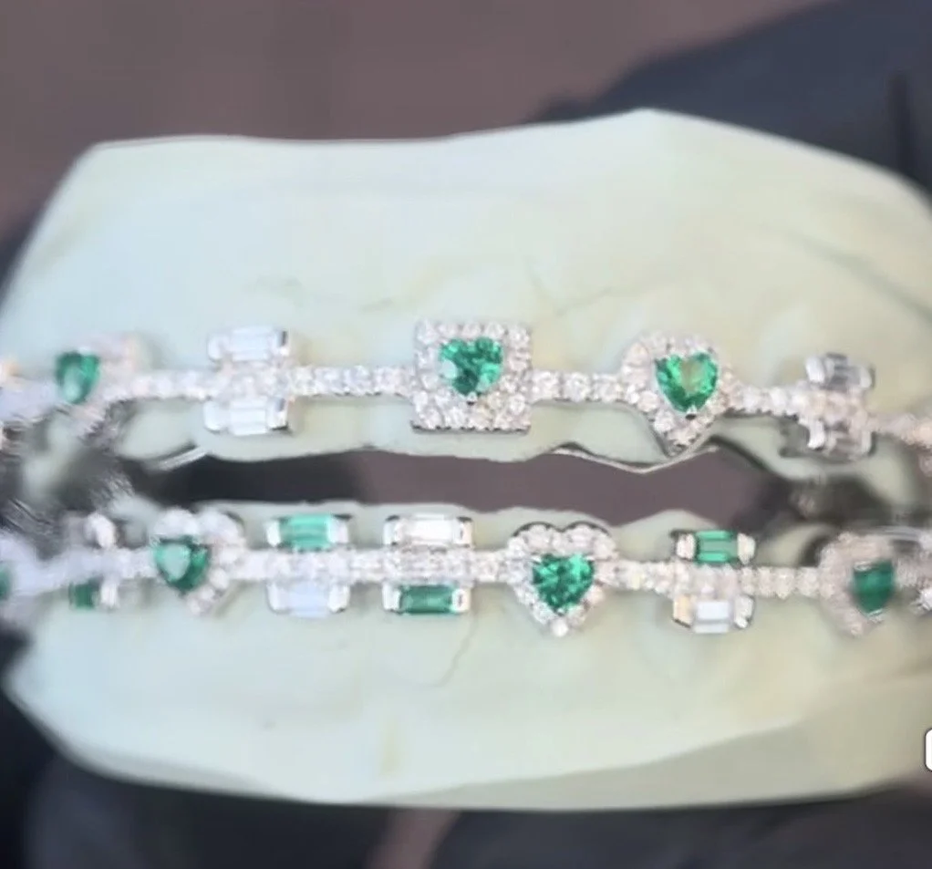 Custom Grillz “Braces” Style