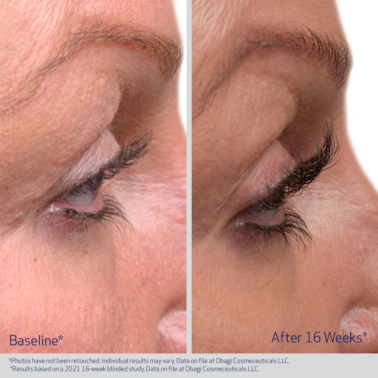 eyelash after.webp