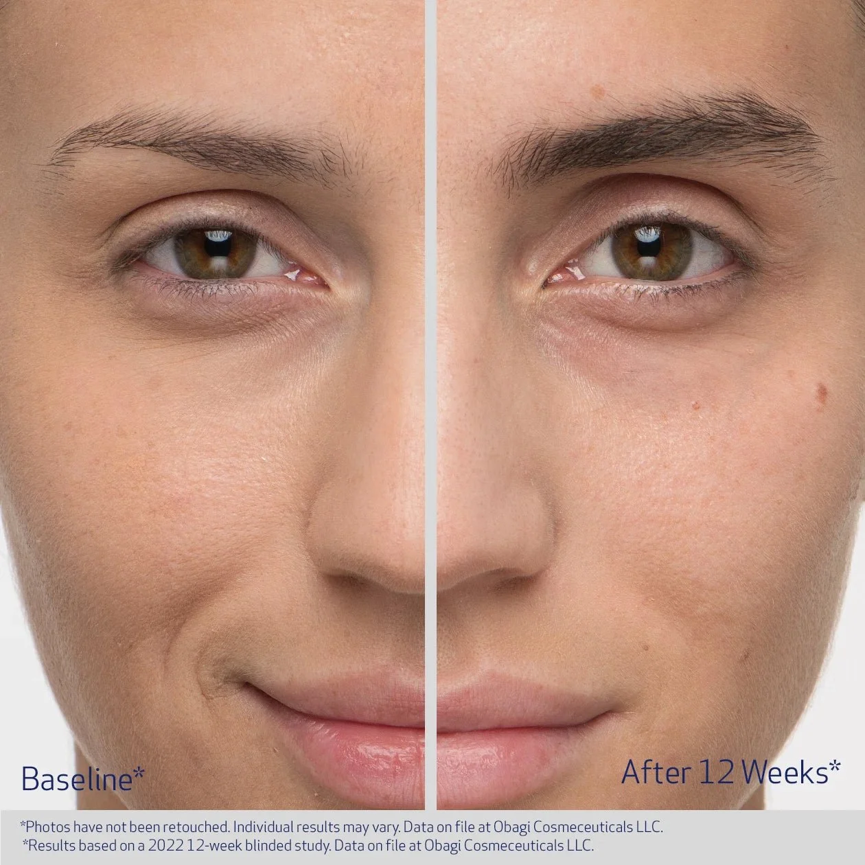 nucil brow results 2.jpeg