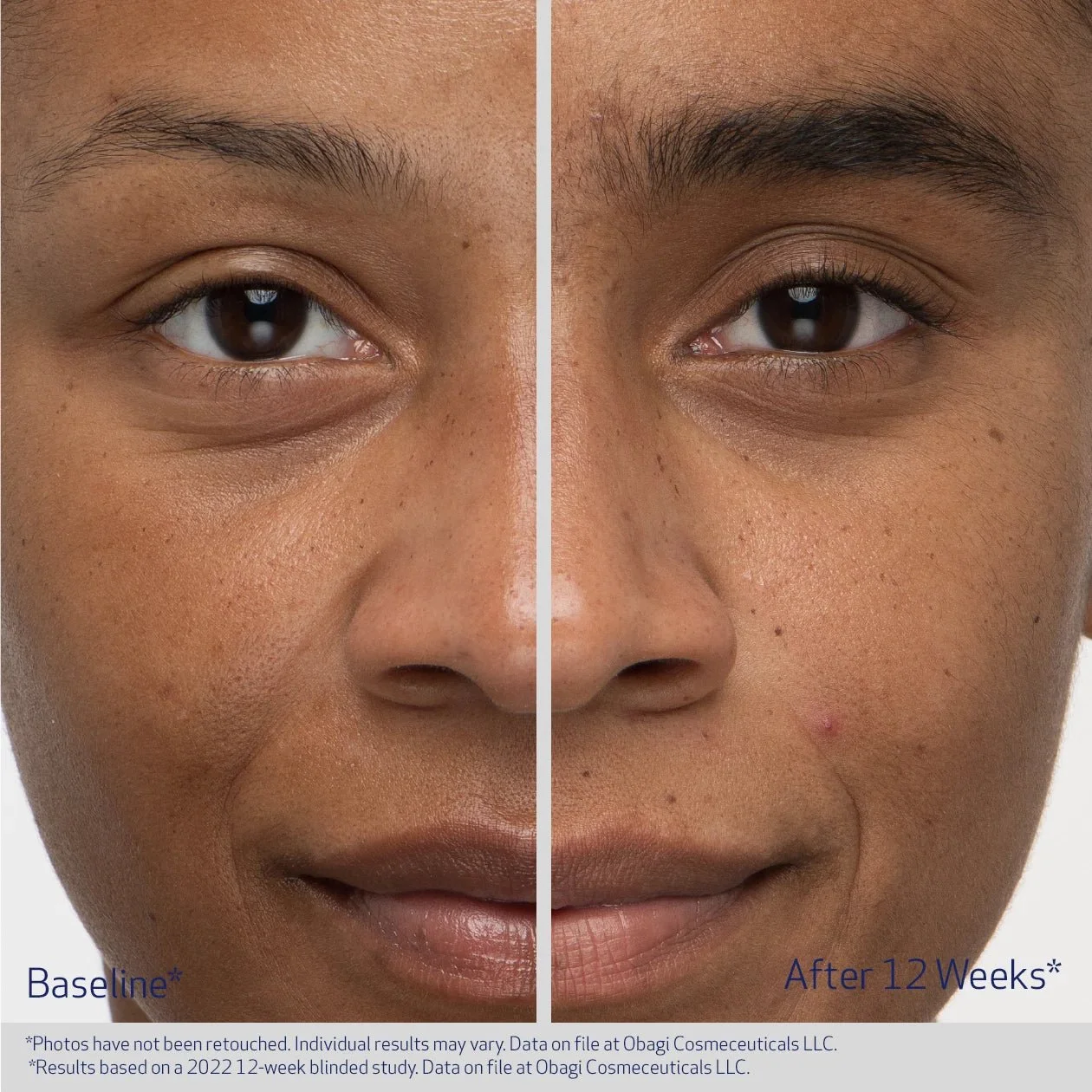 nucil brow results.jpeg