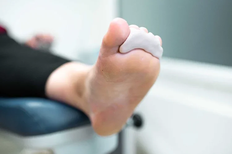 Nahaufnahme eines Fußes mit einer blauen Polsterung im Vordergrund, der mit einem weißen Gegenstand bedeckt ist.