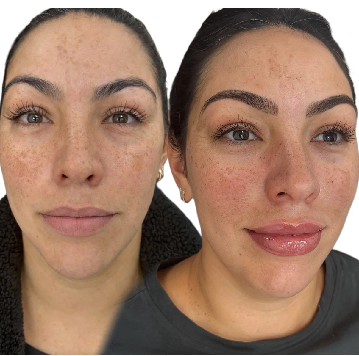 Healed Brows and Lips