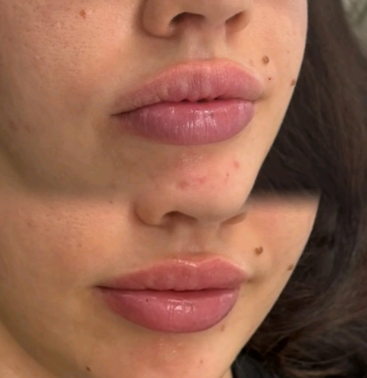 Healed Lip Blush