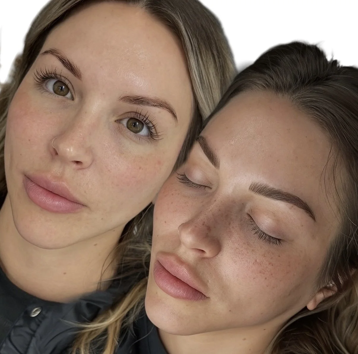 Healed Brows and Freckles