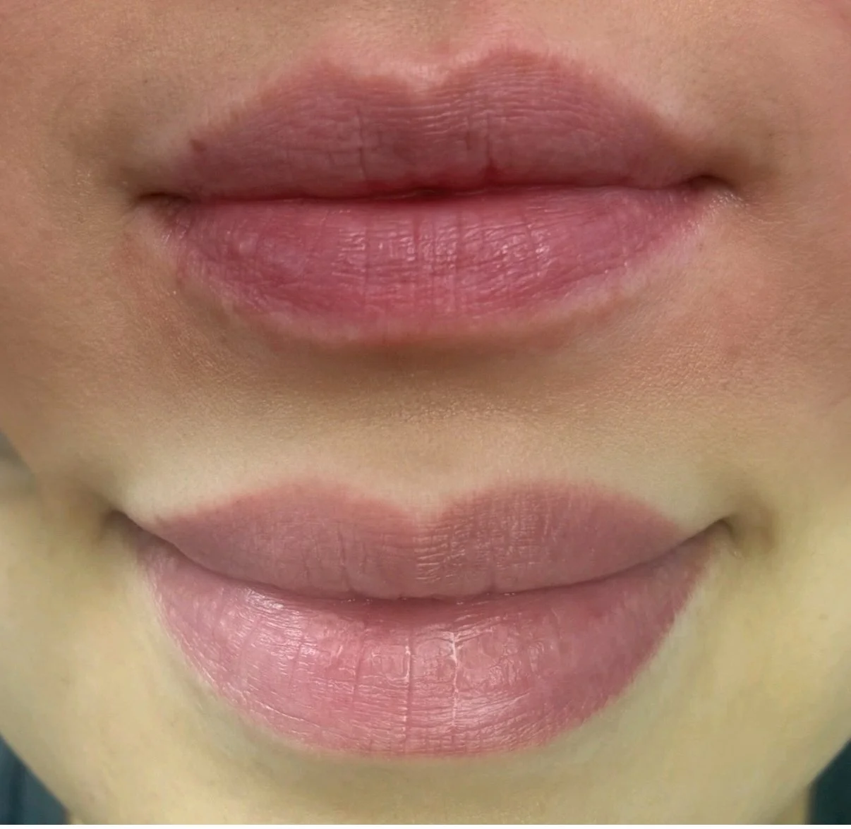 Healed Lip Blush 
