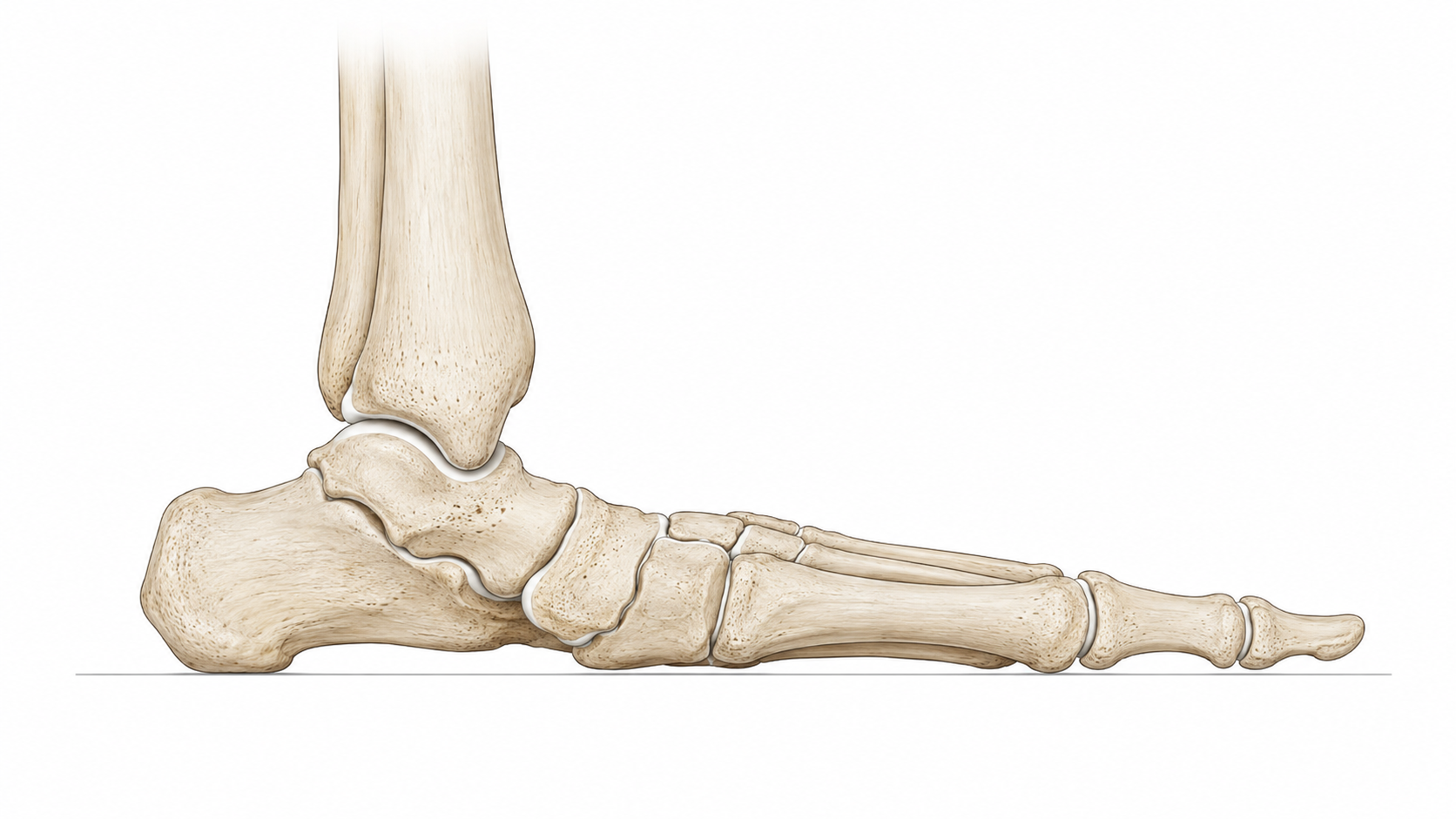Pes Planus (Flat Foot Conditions)