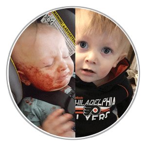 Cyrus’ Eczema Story