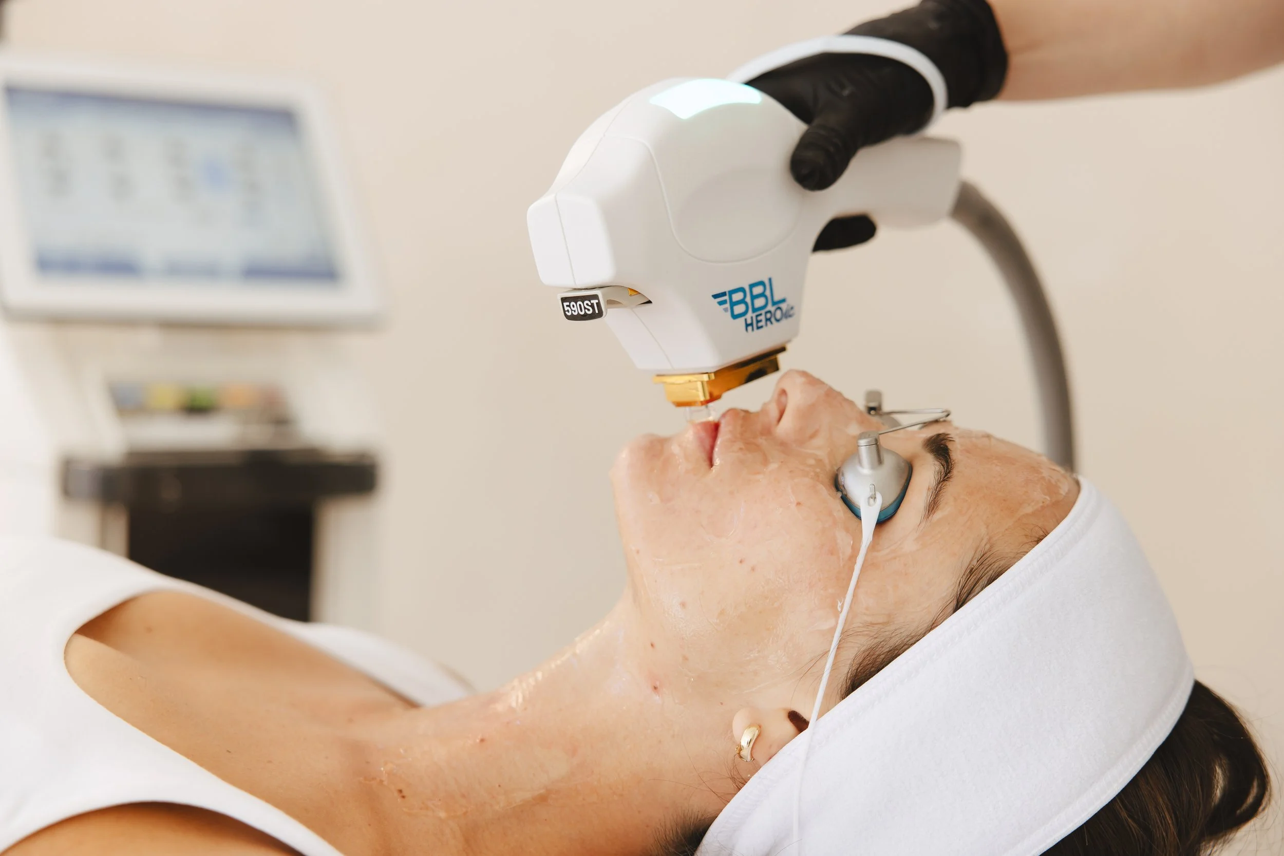 BBL Heroic and Moxi Laser in San Diego | Glowtox Solana Beach