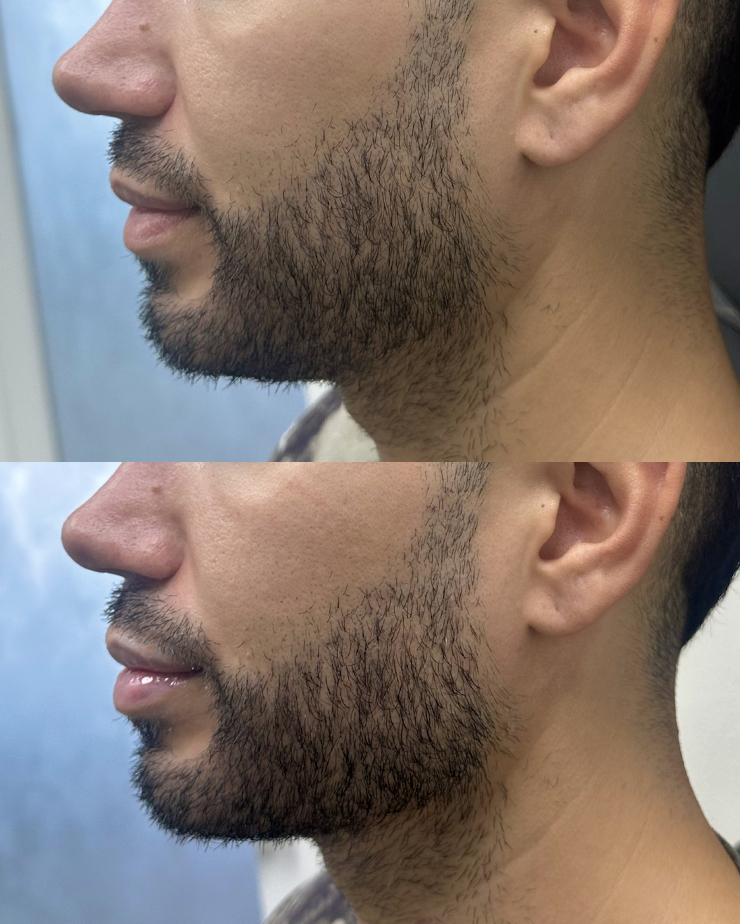 Close-up side profile of a young man's face, showing facial hair and ear against a blurred background.