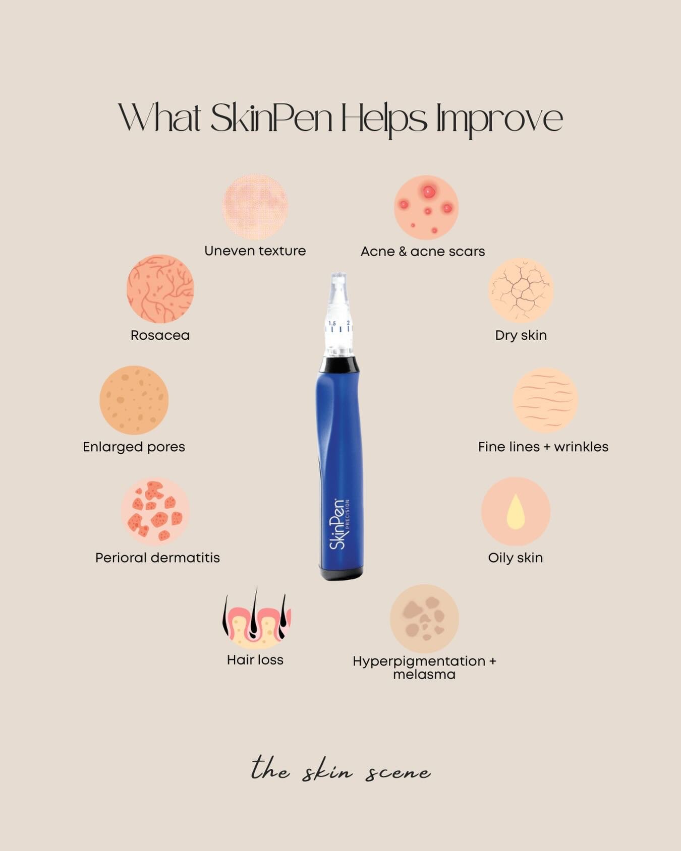 SkinPen microneedling helps improve these skin conditions (and more) by boosting your skin&rsquo;s own collagen from within.

Why we recommend 3 sessions:
1: Kickstarts the skin&rsquo;s repair + collagen production
2: Builds on the results for smooth