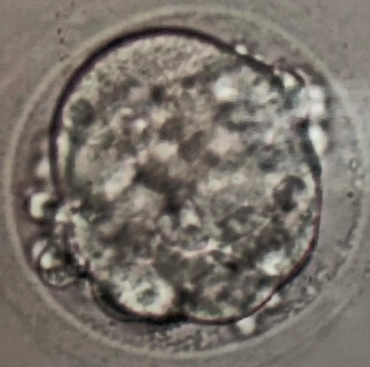 Image of blastocyst in early stages of development.