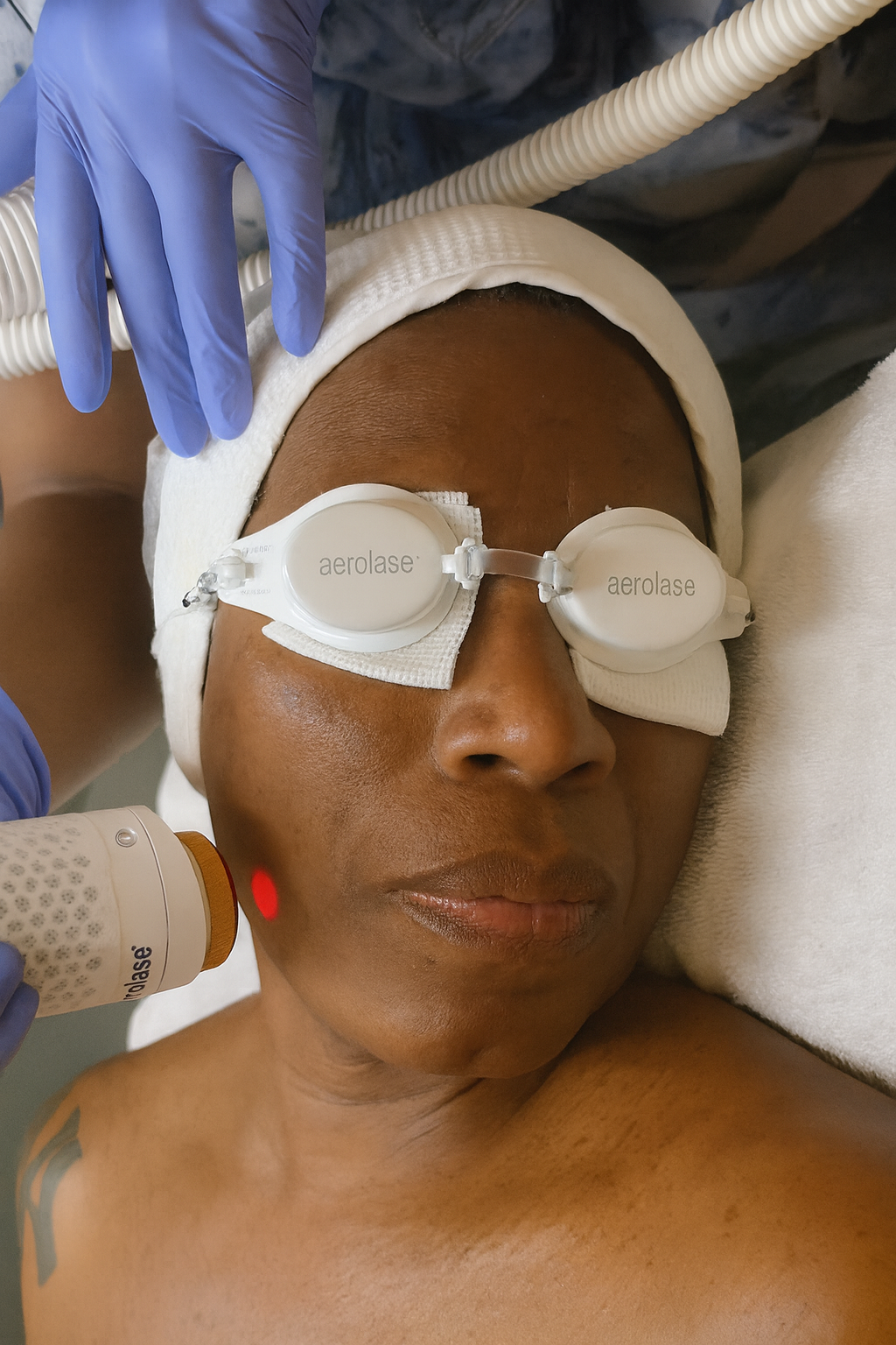 Sculpt Your Jawline &amp; Refresh Your Skin with Aerolase + Injectables