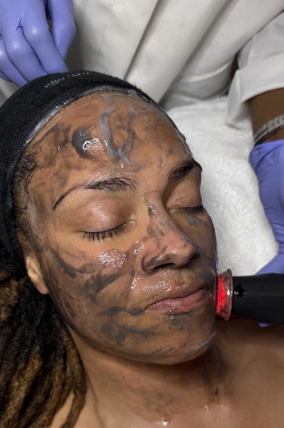 Glo2Facial (Balance)