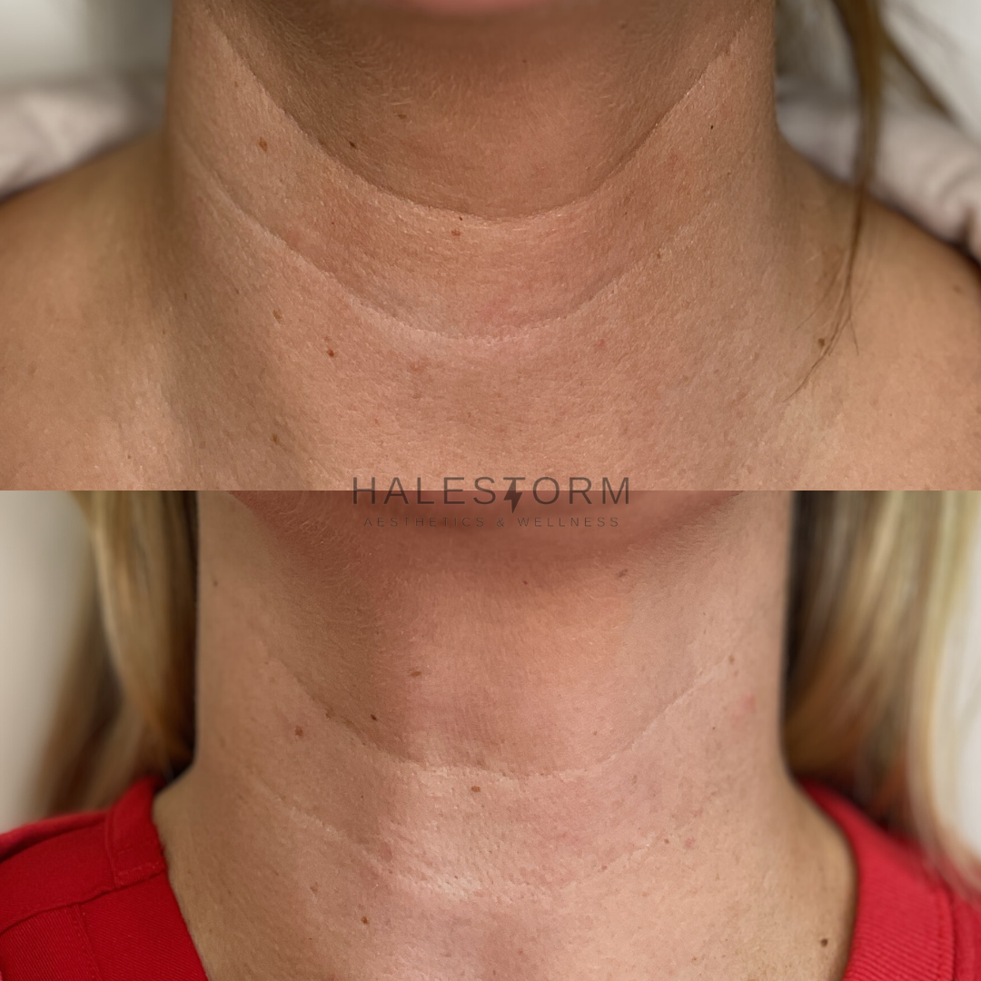 HDR B&A - CASS (1).png
