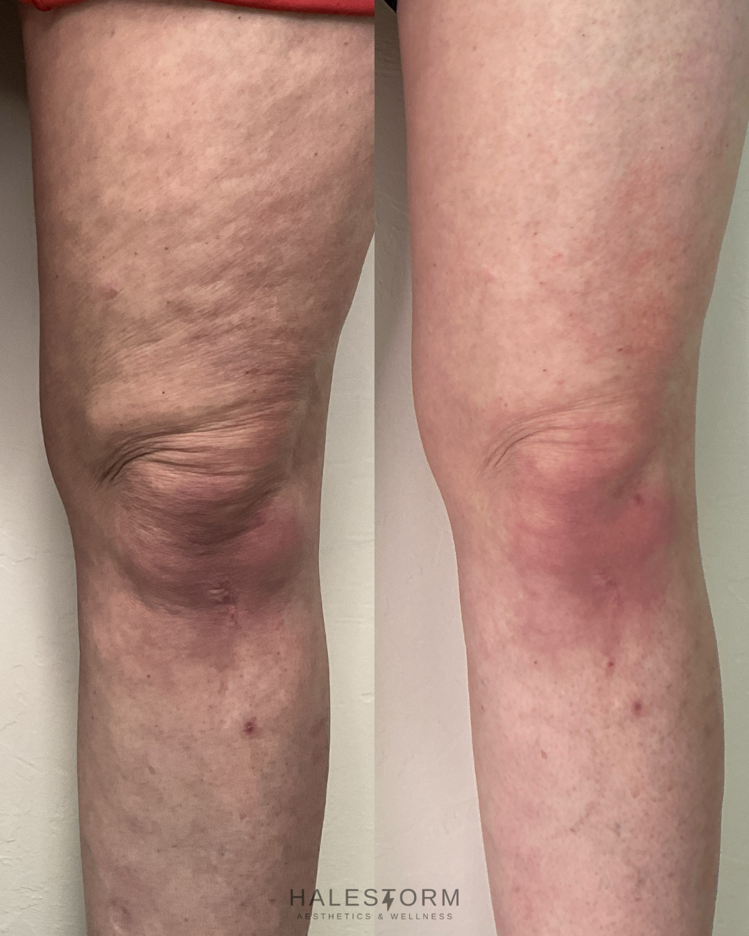 N. ATTEBERRY B&A (1).png