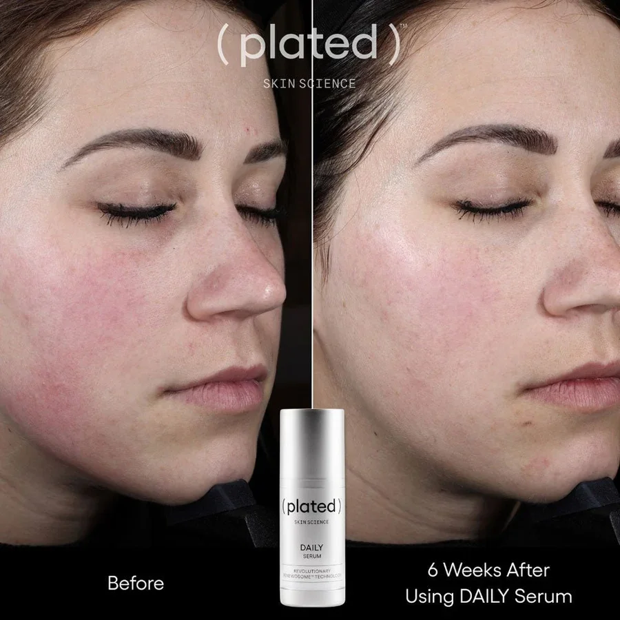 plated-skin-science-daily-serum-578231.webp
