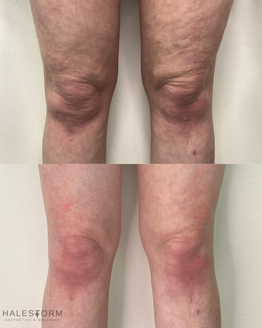 N. ATTEBERRY B&A.png