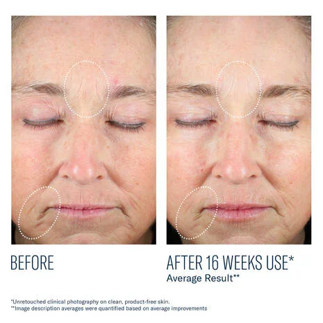 PDP_MystroRevive_8_BeforeAfter_2000x2000_V2_929.webp
