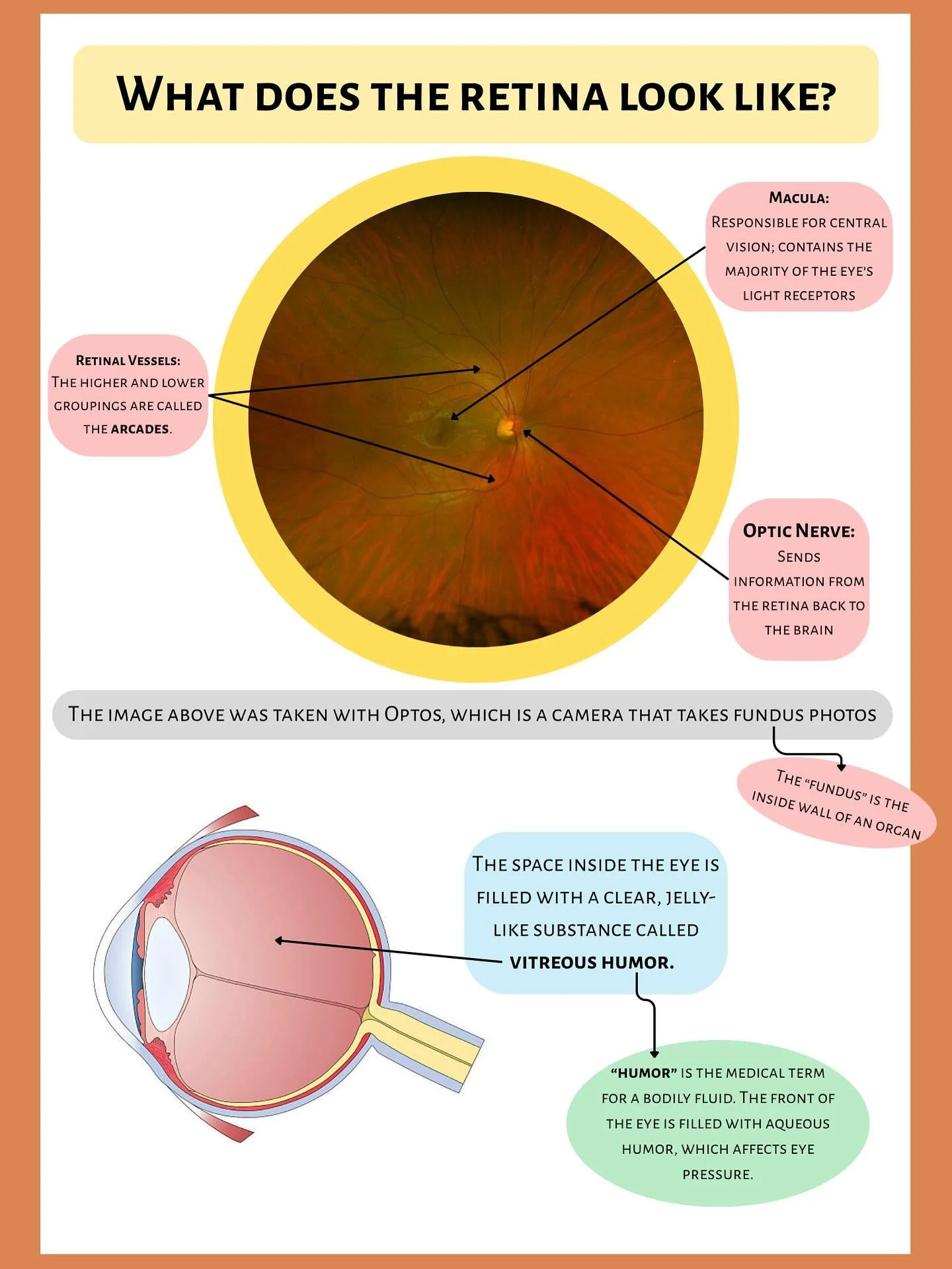 Tuesday Talks 🎙️ 

Retina 101👁️ Optos imaging 

What is Optos/ Fundus Photography? This advanced imaging captures a high-resolution, wide-angle view of the retina&mdash;the light-sensitive tissue at the back of your eye. It&rsquo;s quick, painless,
