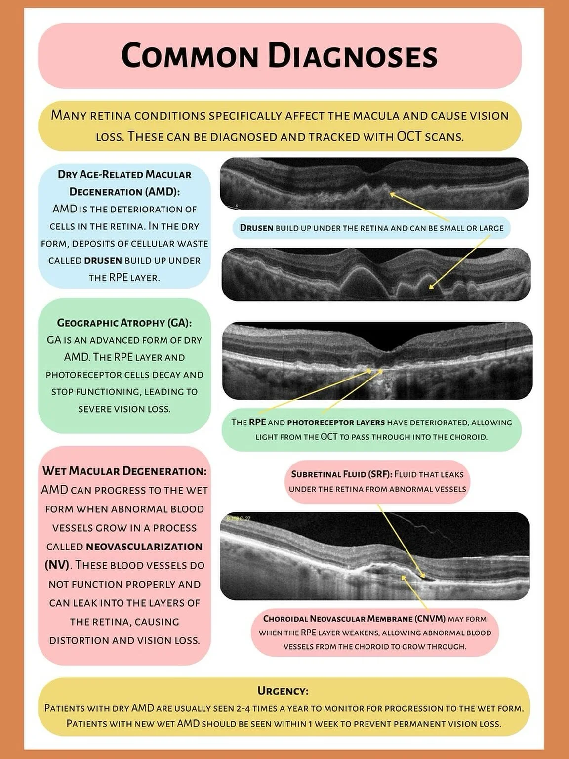 Tuesday Talks🎙️ 

Common Diagnoses 👁️ AMD

What is Age-Related Macular Degeneration (AMD)?
AMD is a leading cause of vision loss in people over 50. It affects the macula, the part of the retina responsible for sharp central vision &mdash; making ta
