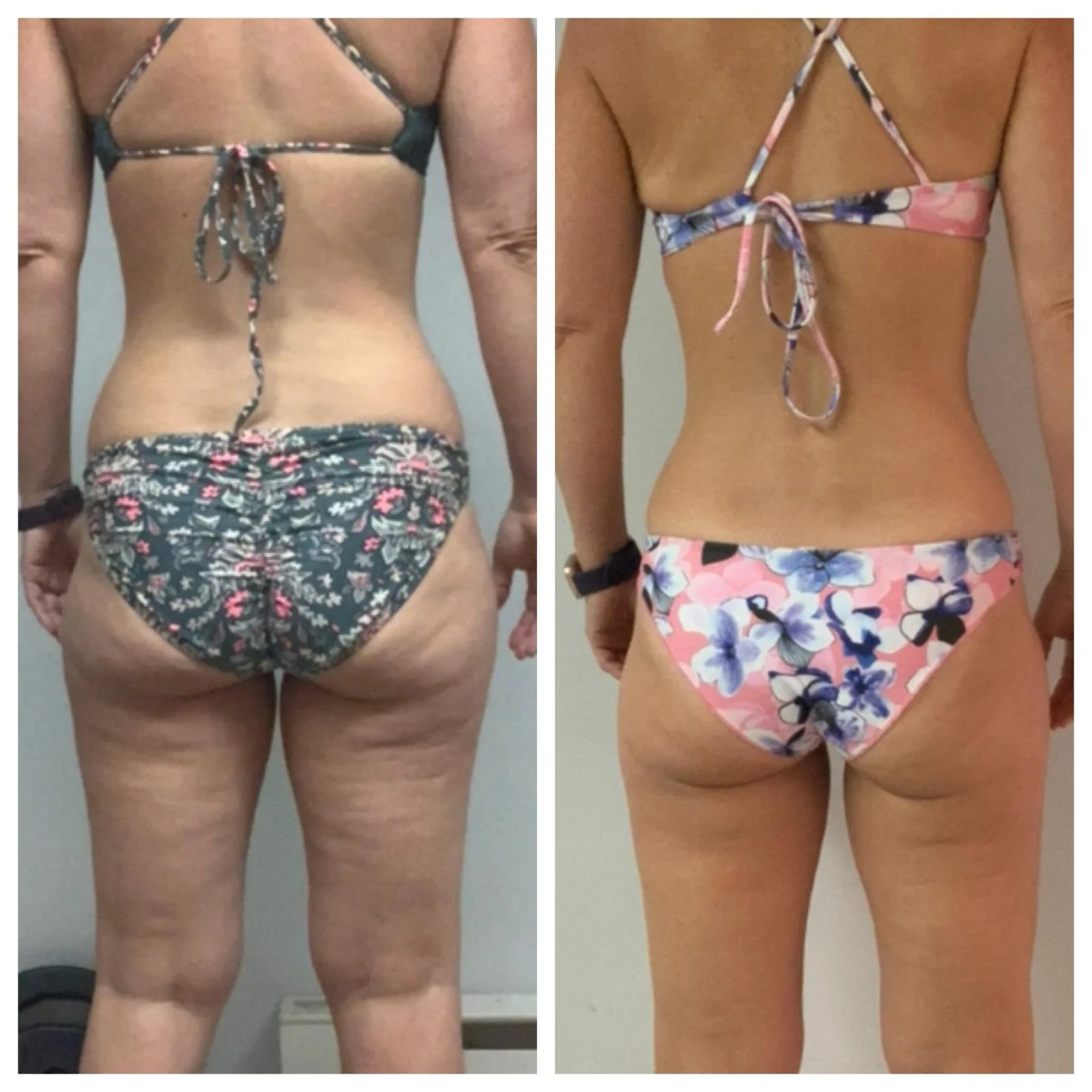 Before/AFTER