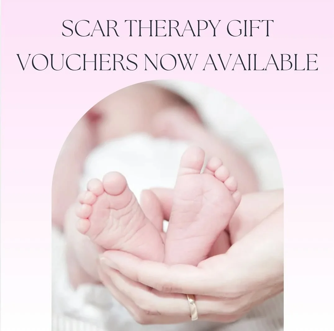 Introducing Scar Therapy Gift Vouchers 🙌🏼

Expecting a little one via C-Section or know someone who is? Scar therapy sessions are the perfect gift for expectant or new mothers, helping to support healing and self-care during recovery following a C-
