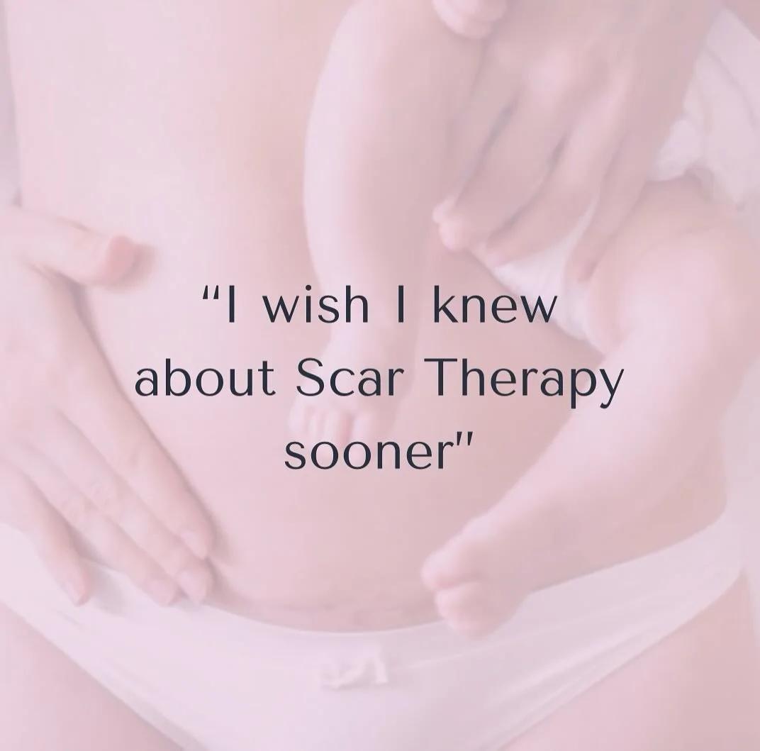 I hear this all the time. The fact is, scar therapy has historically been reserved for certain groups of patients  within the NHS, so it isn&rsquo;t surprising that as a person who&rsquo;s had a C Section, you&rsquo;ve not heard of it either. 

Scar 