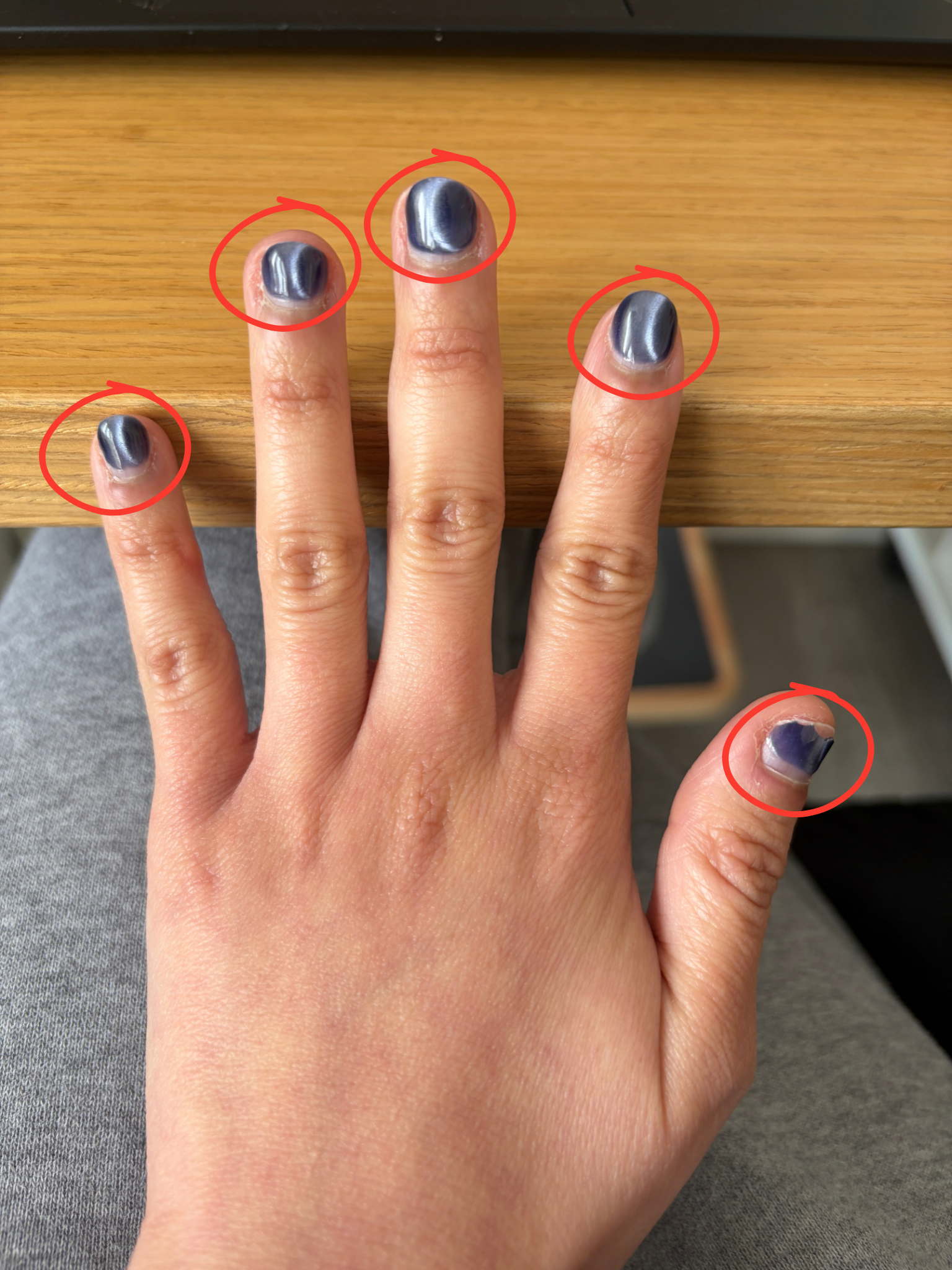A client's hand with chipped polish, with the nail polish being circled in red, showing that most nail professionals only notice color.