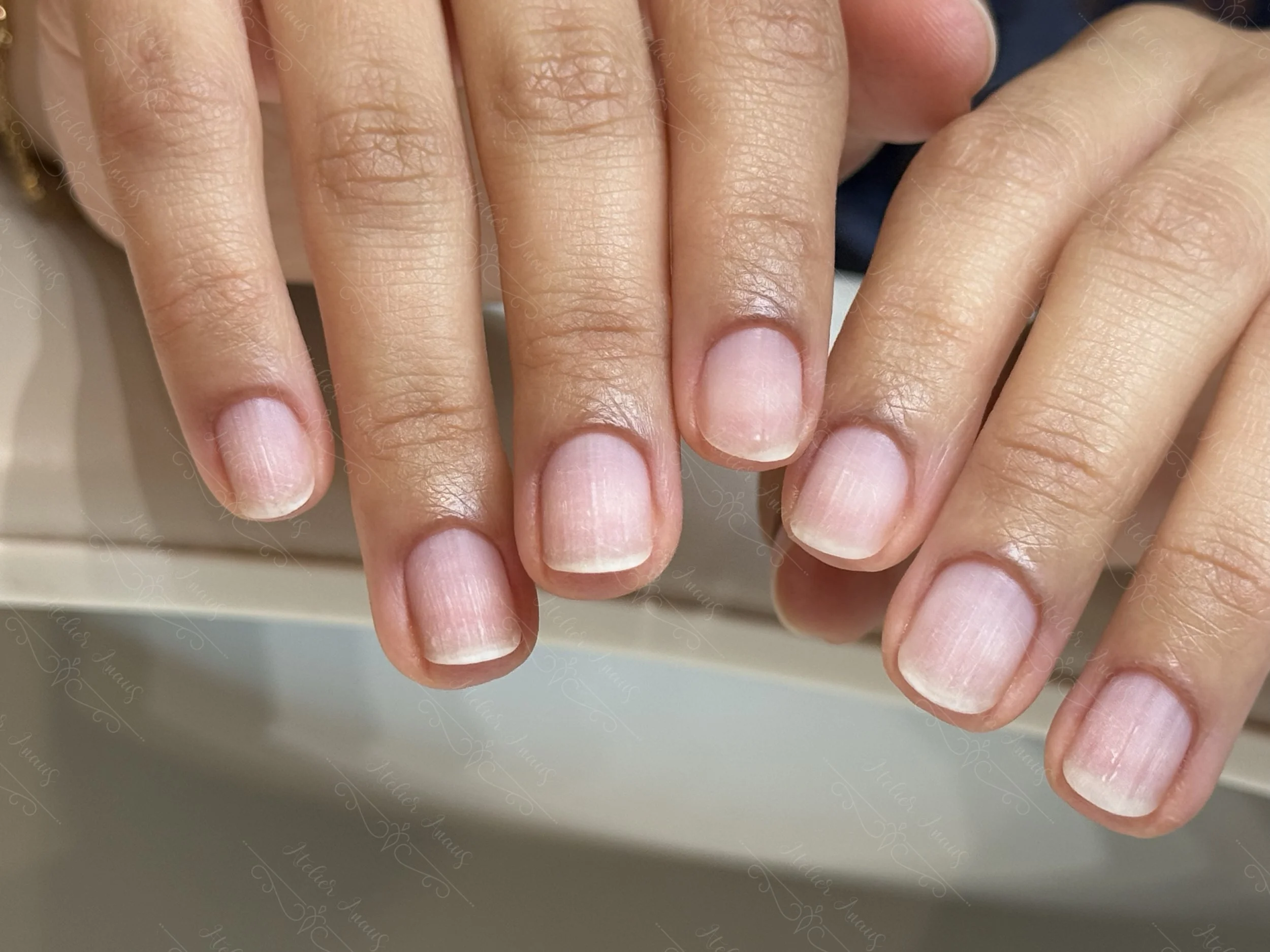 After nail biting recovery at Atelier Anaiis, showing nails that are healthy, beautiful, and strong.