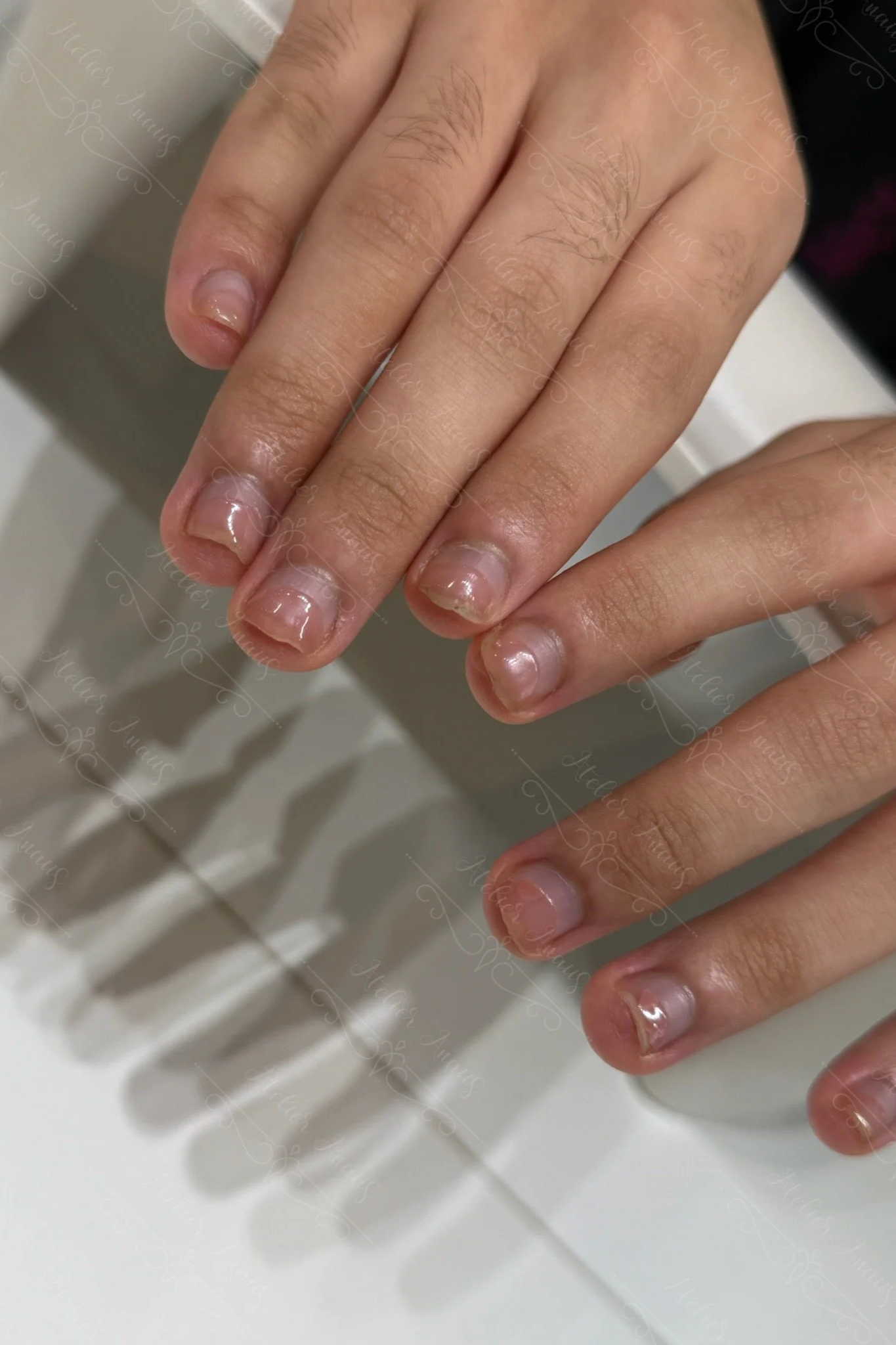 Nails that are recovering from years of nail biting, growing longer and stronger. Nail biting recovery at Atelier Anaiis. 