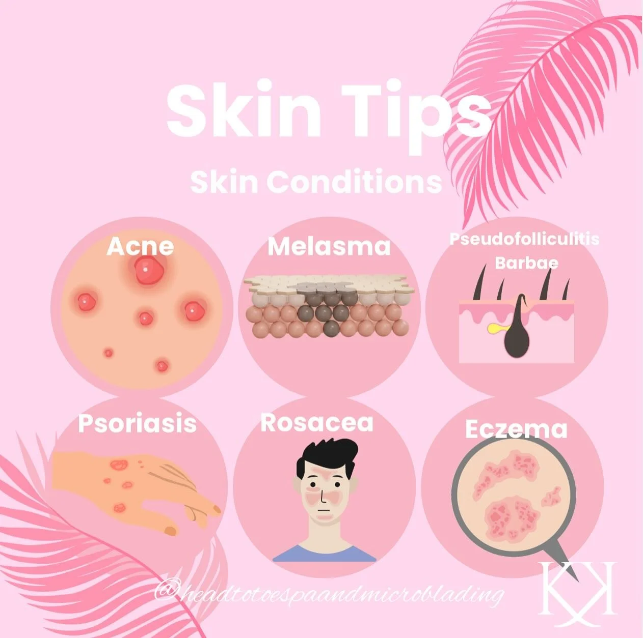 🔹 Psoriasis – A chronic autoimmune disease characterized by rapid skin cell turnover, leading to thickened, scaly plaques and inflammation.
🔹 Melasma – A pigmentary disorder often triggered by UV exposure, hormonal changes, or heat, pre