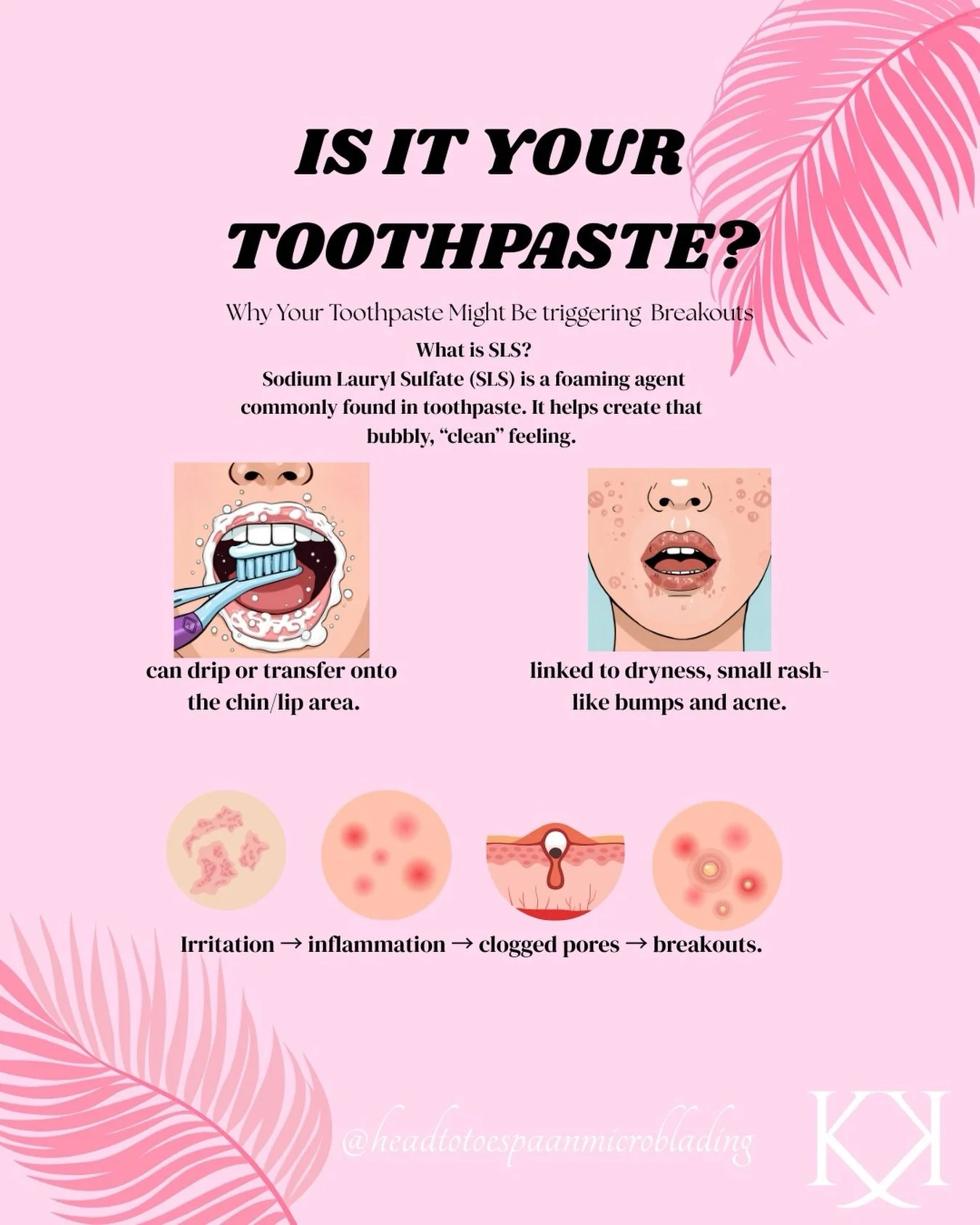 Is your toothpaste secretly causing your breakouts? 👀

That stubborn acne around the mouth + chin area might not be your skincare&hellip; it could be your toothpaste&mdash;specifically sodium lauryl sulfate (SLS).

Here&rsquo;s how to help prevent i