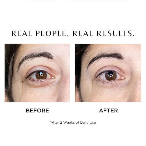 Cosmedix Elite I-Complex Advanced Eye Gel