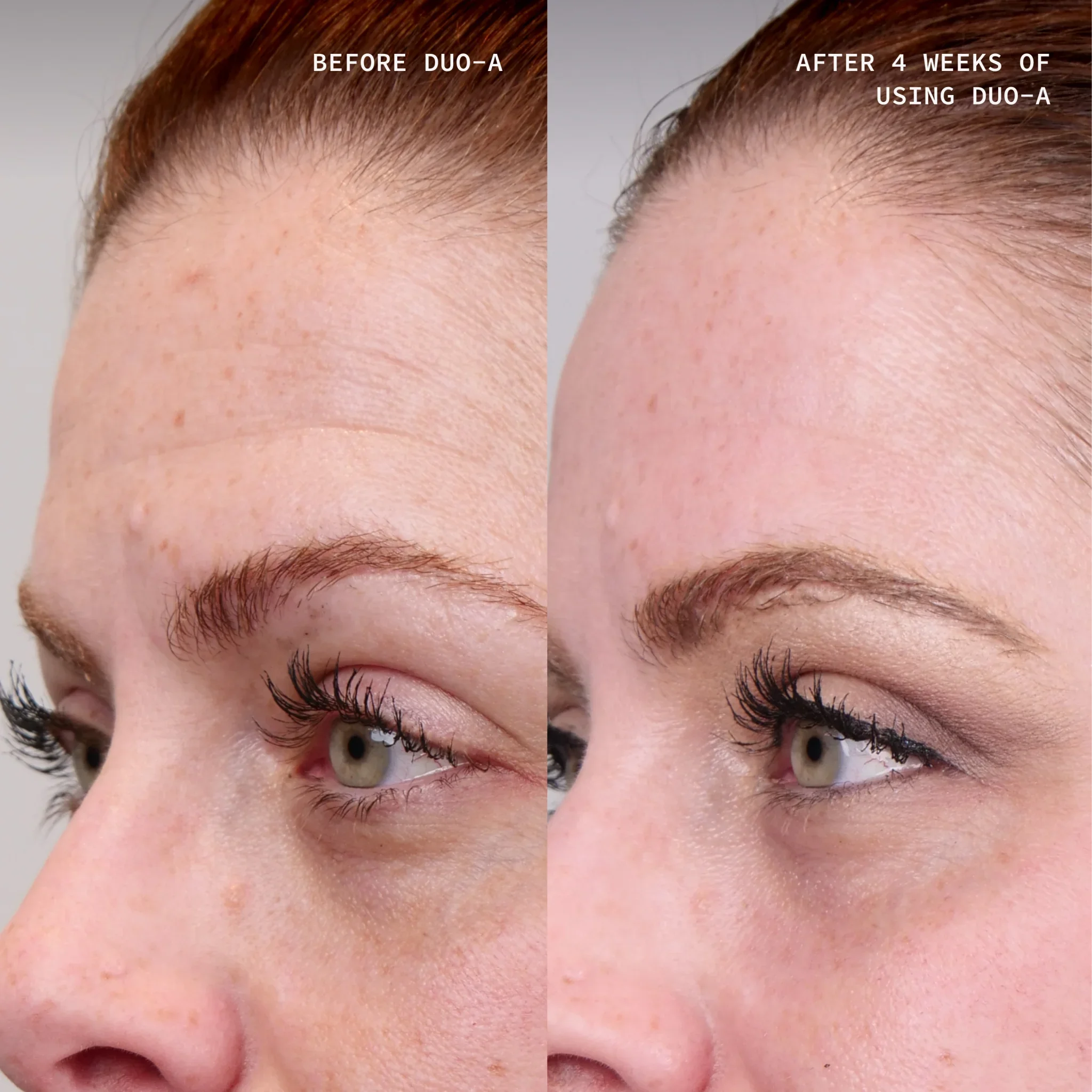 Cosmedix Elite Duo A Serum