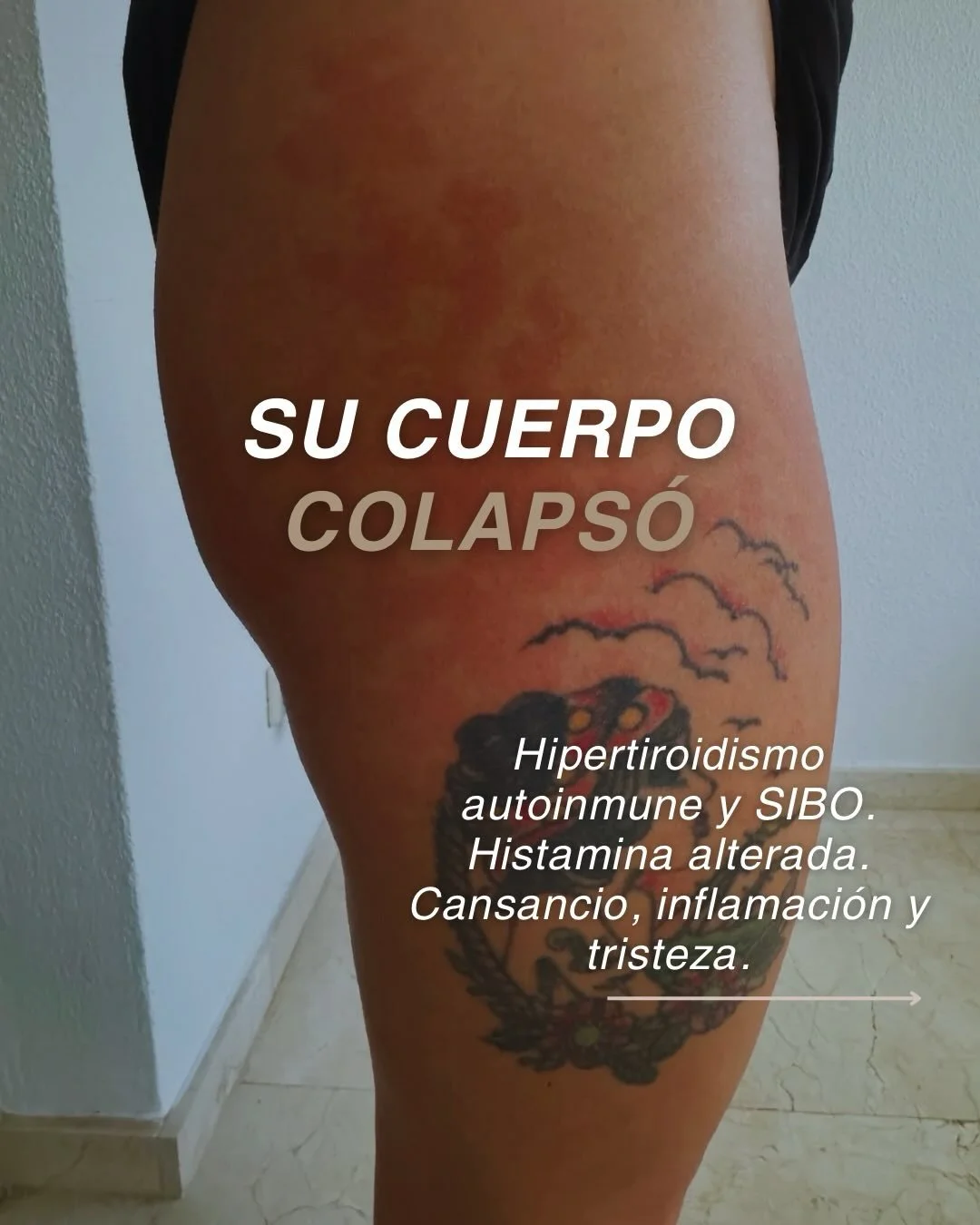 Durante a&ntilde;os crey&oacute; que su cuerpo estaba fallando. Pero en realidad estaba agotado de sostener demasiado.
Cuando el estr&eacute;s se cronifica y las emociones no se procesan, el cuerpo entra en supervivencia. Y desde ah&iacute; aparecen 