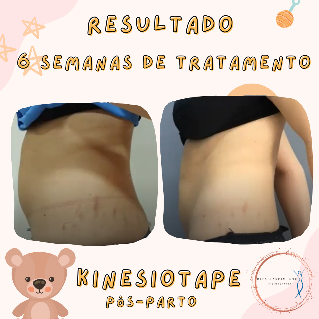 Post Instagram casamento.png