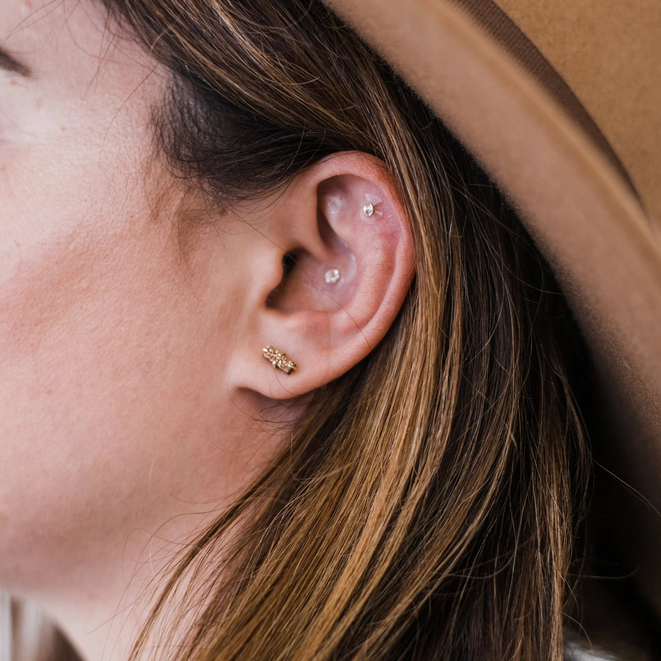 Acupuncture in Costa Mesa, Newport Beach & Orange County Magnolia