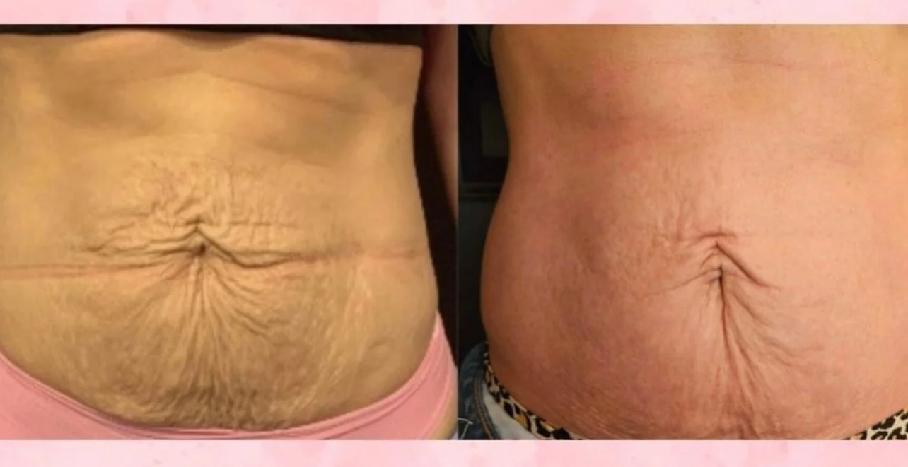 image_123650291 (5).JPG