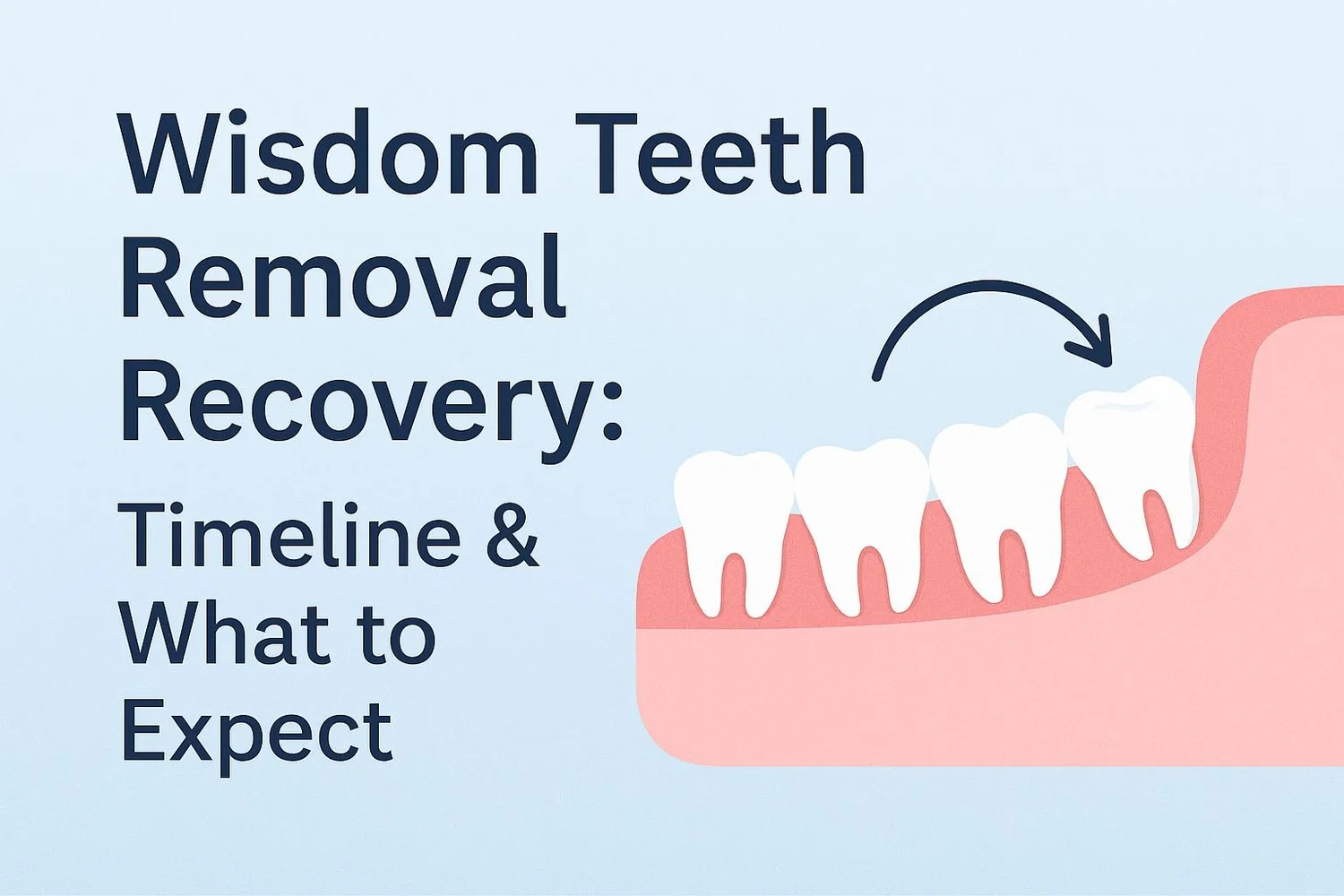 Wisdom Teeth Removal Recovery: Timeline & What to Expect | Carnegie Dental