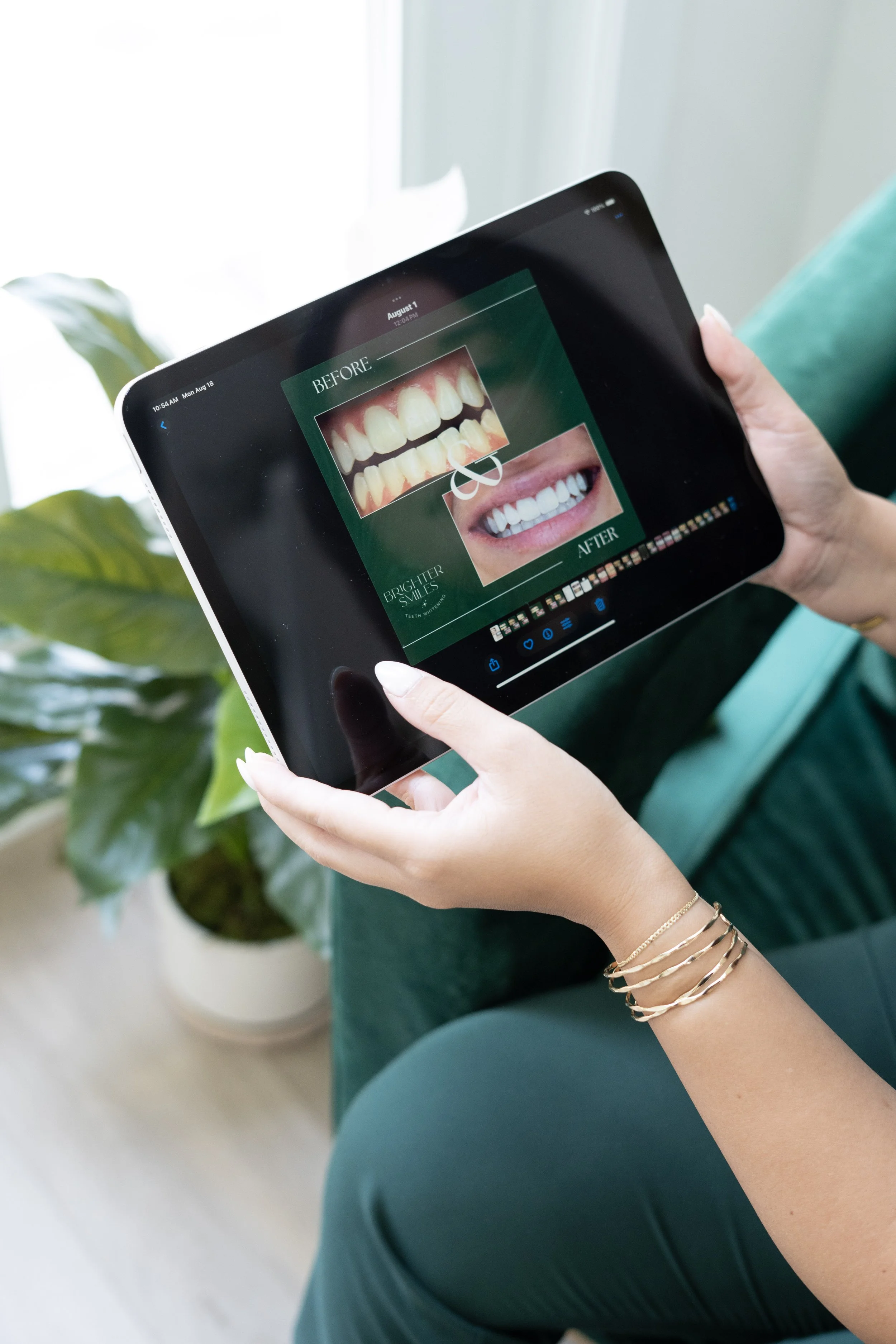 Teeth Whitening Aftercare: How to Keep Your Smile Brighter, Longer