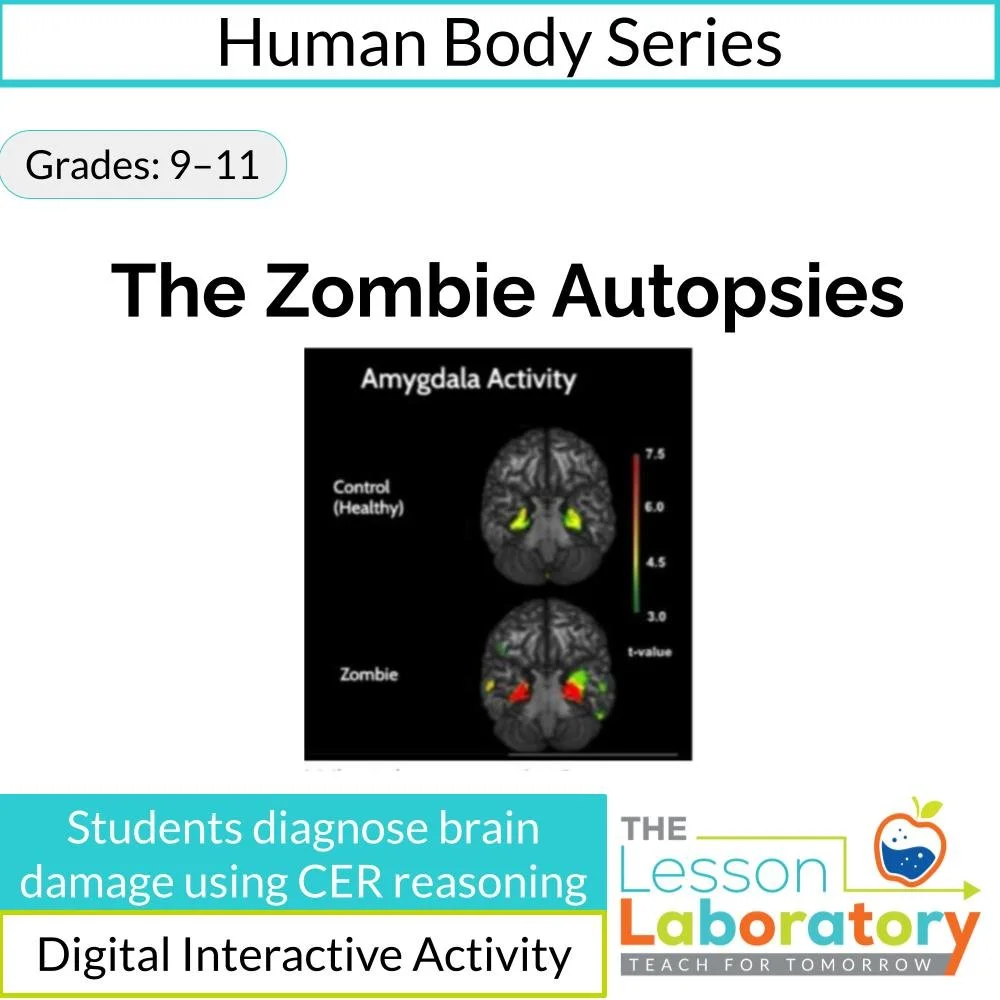Human Brain Structure & Function Case Study: Zombie Autopsy CER Investigation