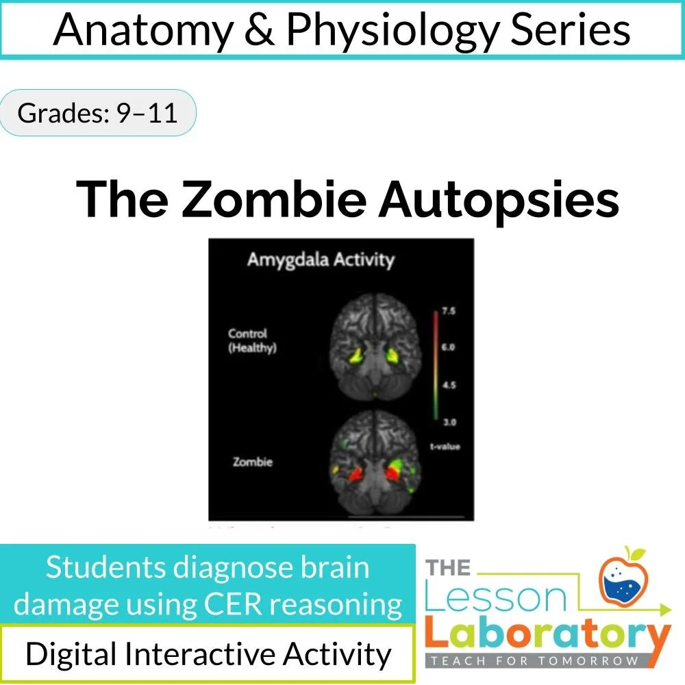 Human Brain Structure & Function Case Study: Zombie Autopsy CER Investigation