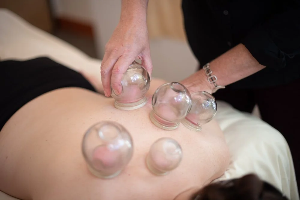 Person receiving cupping therapy on their back with five glass cups applied.
