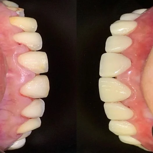 emax_5.jpg