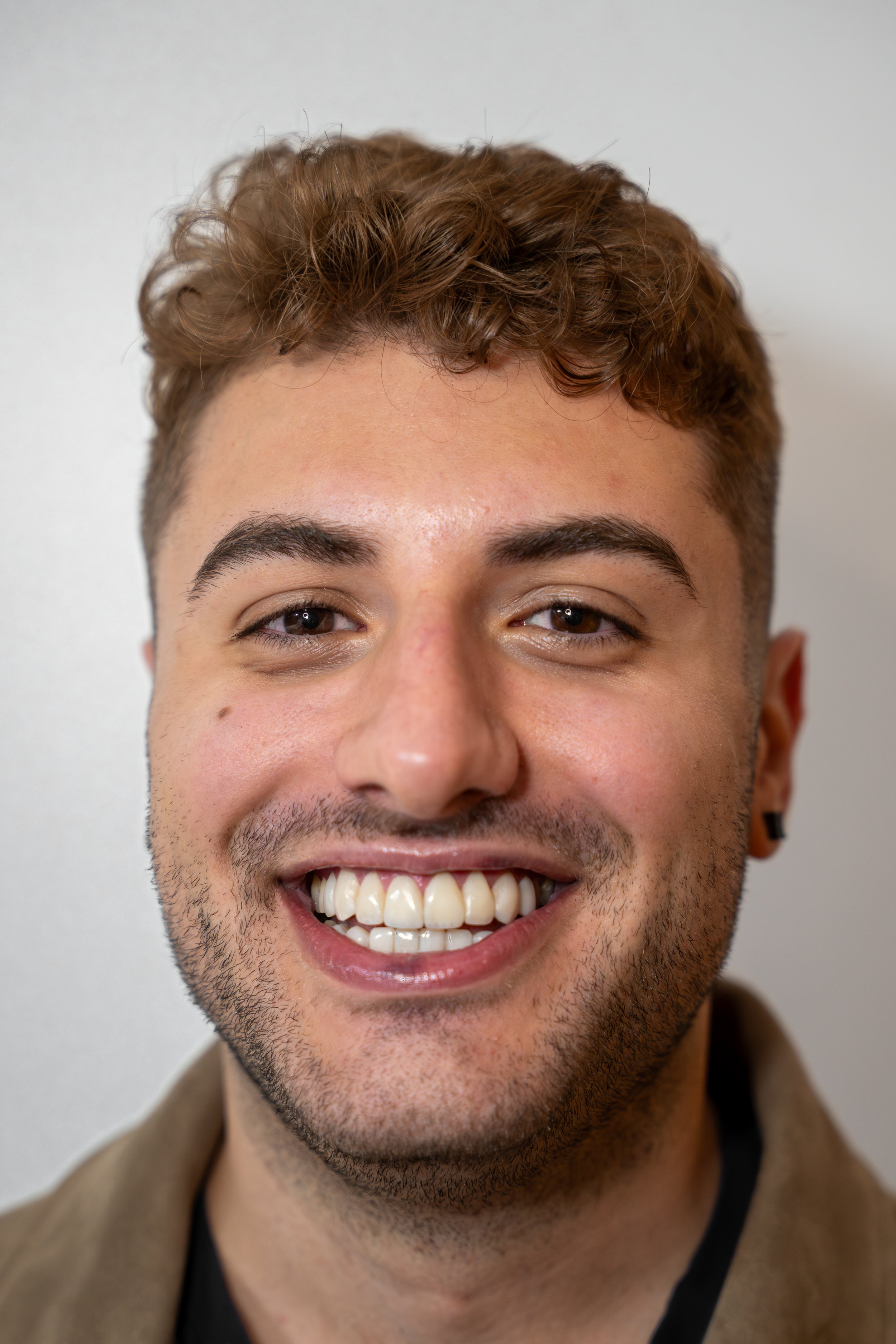 How Many Days Do You Need in Bogotá for Veneers?