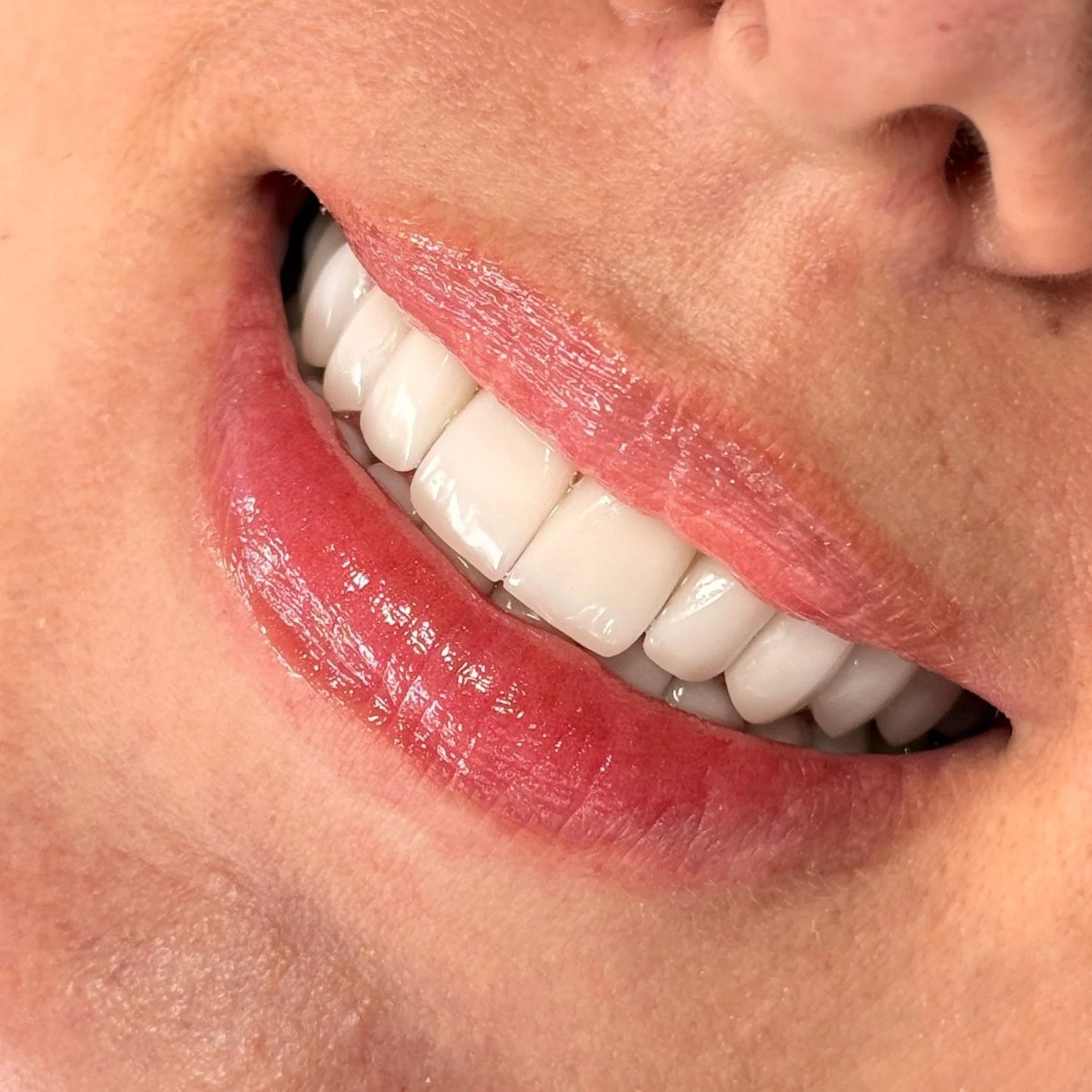 smile design bogota