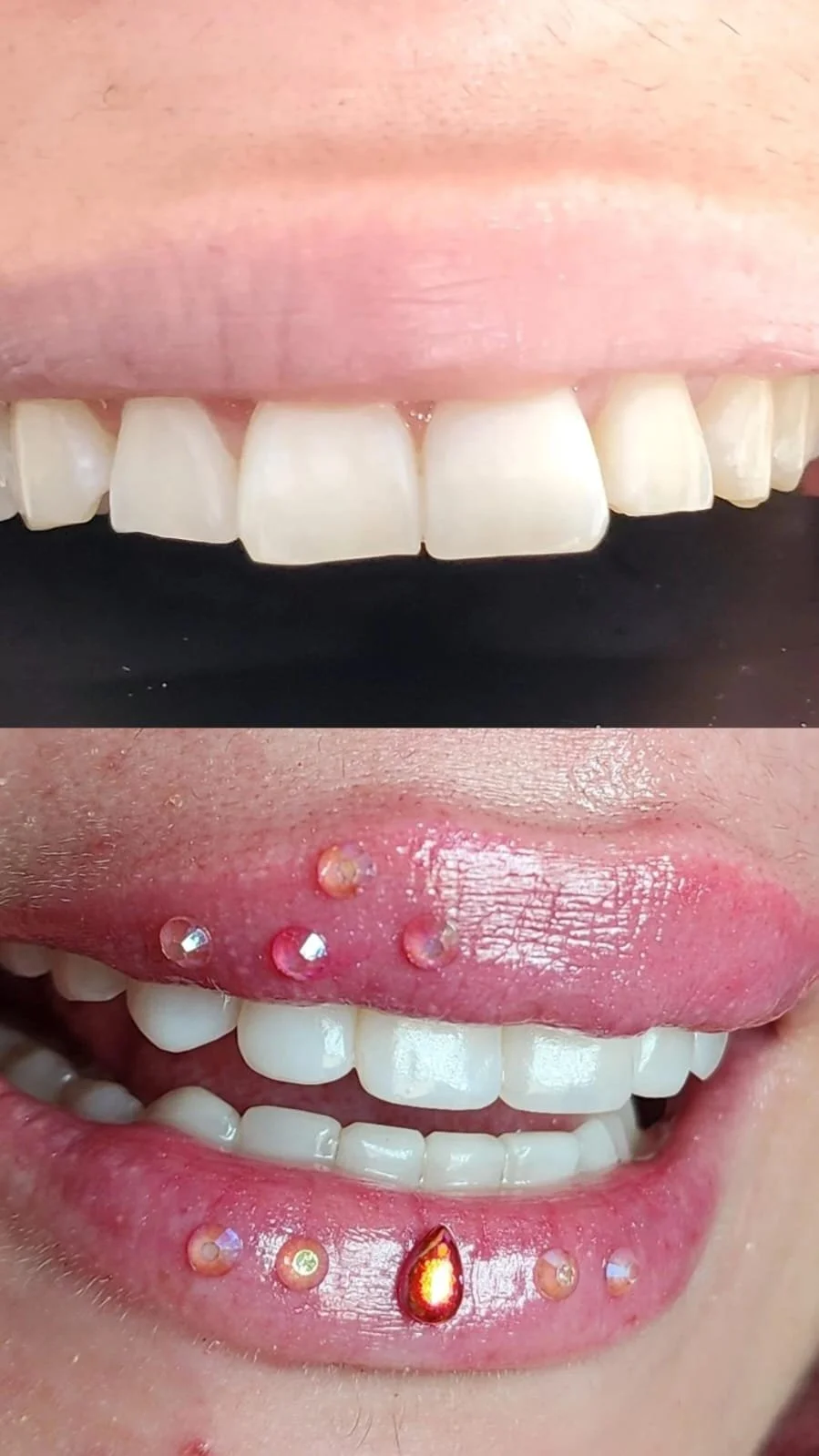 Micro diseño, mini diseño de sonrisa